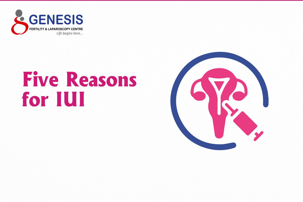  Five Reasons for IUI